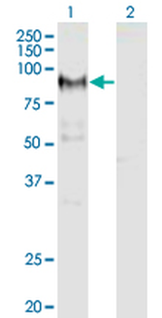 ADAM12 monoclonal antibody (M01), clone 1G3