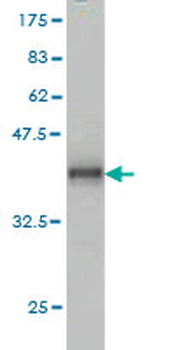 ADAM12 monoclonal antibody (M01), clone 1G3