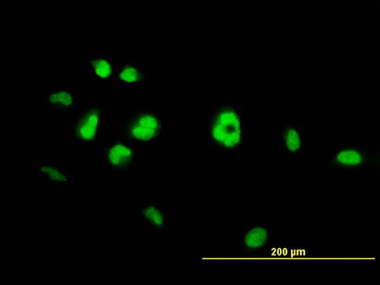 NR4A3 monoclonal antibody (M06), clone 1E11