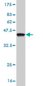 NR4A3 monoclonal antibody (M06), clone 1E11