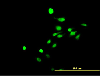 NR4A3 monoclonal antibody (M02), clone 1E9