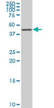 NR4A3 monoclonal antibody (M02), clone 1E9