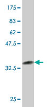 NR4A3 monoclonal antibody (M02), clone 1E9