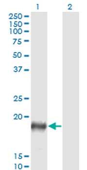 PSCA monoclonal antibody (M03), clone 5C2