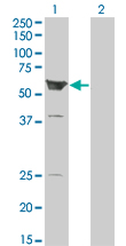 ARHGEF5 monoclonal antibody (M01), clone 3A12-B5
