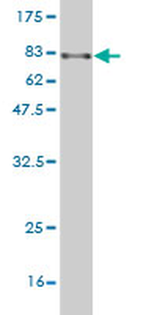 ARHGEF5 monoclonal antibody (M01), clone 3A12-B5