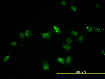 TFEB monoclonal antibody (M01), clone S1