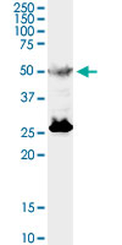 TFEB monoclonal antibody (M01), clone S1