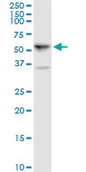 ALDH5A1 purified MaxPab mouse polyclonal antibody (B01P)