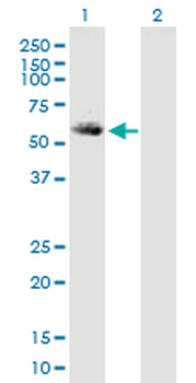 ALDH5A1 purified MaxPab mouse polyclonal antibody (B01P)