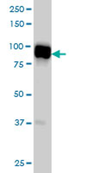 SLMAP monoclonal antibody (M08), clone 2A7