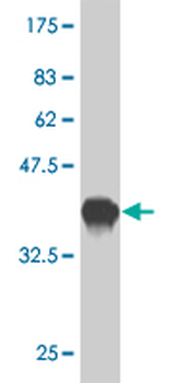 SLMAP monoclonal antibody (M08), clone 2A7