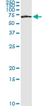 FZD5 monoclonal antibody (M01), clone 6A3