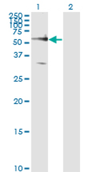 FZD5 monoclonal antibody (M01), clone 6A3