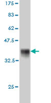 FZD5 monoclonal antibody (M01), clone 6A3