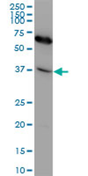 CXCR4 monoclonal antibody (M04), clone 2G9