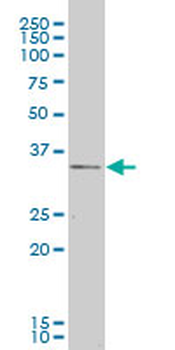 CXCR4 monoclonal antibody (M04), clone 2G9
