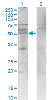 CXCR4 monoclonal antibody (M04), clone 2G9