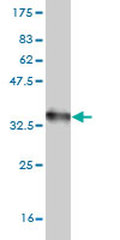 CXCR4 monoclonal antibody (M04), clone 2G9