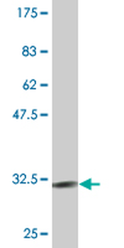 CXCR4 monoclonal antibody (M02), clone 1F8