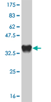 CXCR4 monoclonal antibody (M01), clone 2H5