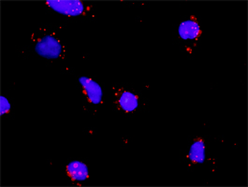 IL1R2 monoclonal antibody (M01), clone 1G12