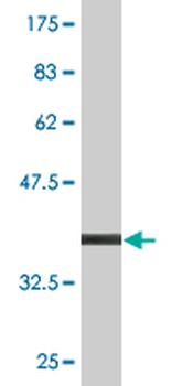 IL1R2 monoclonal antibody (M01), clone 1G12