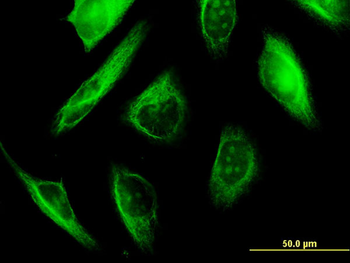 TUBA1A monoclonal antibody (M06), clone 2D2