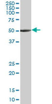 TUBA1A monoclonal antibody (M06), clone 2D2