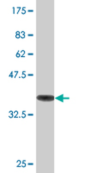 TUBA1A monoclonal antibody (M06), clone 2D2