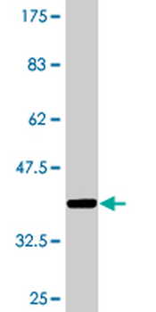 LRP8 monoclonal antibody (M02), clone 1A1