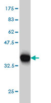 LRP8 monoclonal antibody (M01), clone 3H2