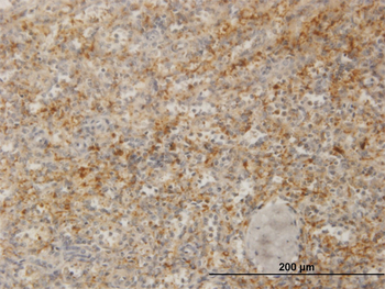 ZYX monoclonal antibody (M02), clone 2D1