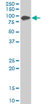ZYX monoclonal antibody (M02), clone 2D1