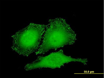 ZYX monoclonal antibody (M01), clone 2C10-4A7