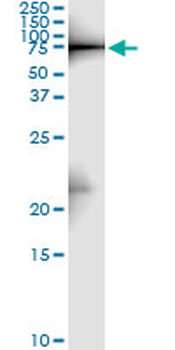 ZYX monoclonal antibody (M01), clone 2C10-4A7