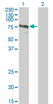 ZYX monoclonal antibody (M01), clone 2C10-4A7