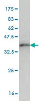 ZNF131 monoclonal antibody (M07), clone 5F1