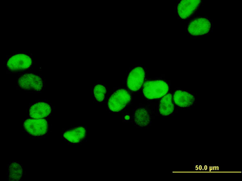 XRCC5 monoclonal antibody (M02), clone 3D8