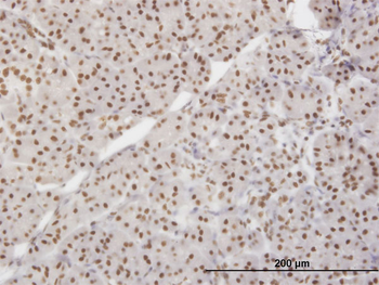 XRCC5 monoclonal antibody (M02), clone 3D8
