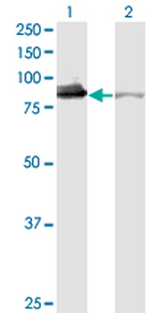 XRCC5 monoclonal antibody (M02), clone 3D8