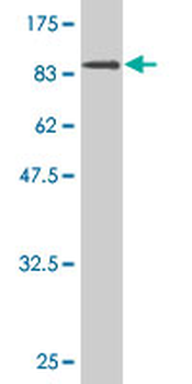 XRCC5 monoclonal antibody (M02), clone 3D8