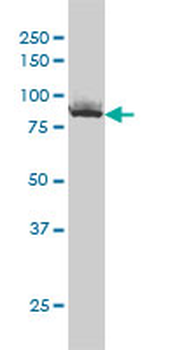 XRCC5 monoclonal antibody (M02), clone 3D8