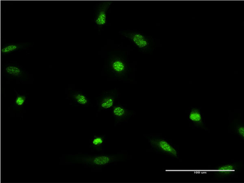 XRCC2 monoclonal antibody (M01), clone 2H4