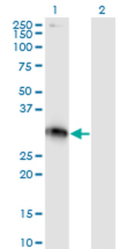 XRCC2 monoclonal antibody (M01), clone 2H4