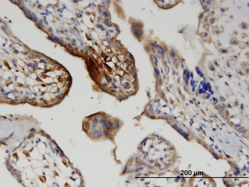WNT5A monoclonal antibody (M04), clone 3A4