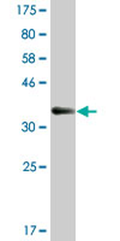 WEE1 monoclonal antibody (M01A), clone 5B6