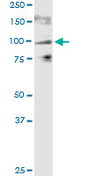 TRPV1 monoclonal antibody (M02), clone 1A8