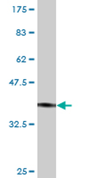 VIPR2 monoclonal antibody (M01), clone 2E3