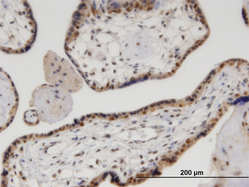VCP monoclonal antibody (M03), clone 4A8